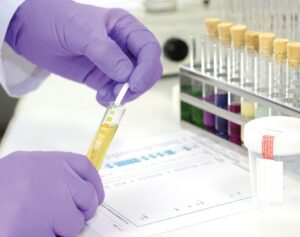 Learn how DIS supports smart hiring with Drug & Alcohol Testing